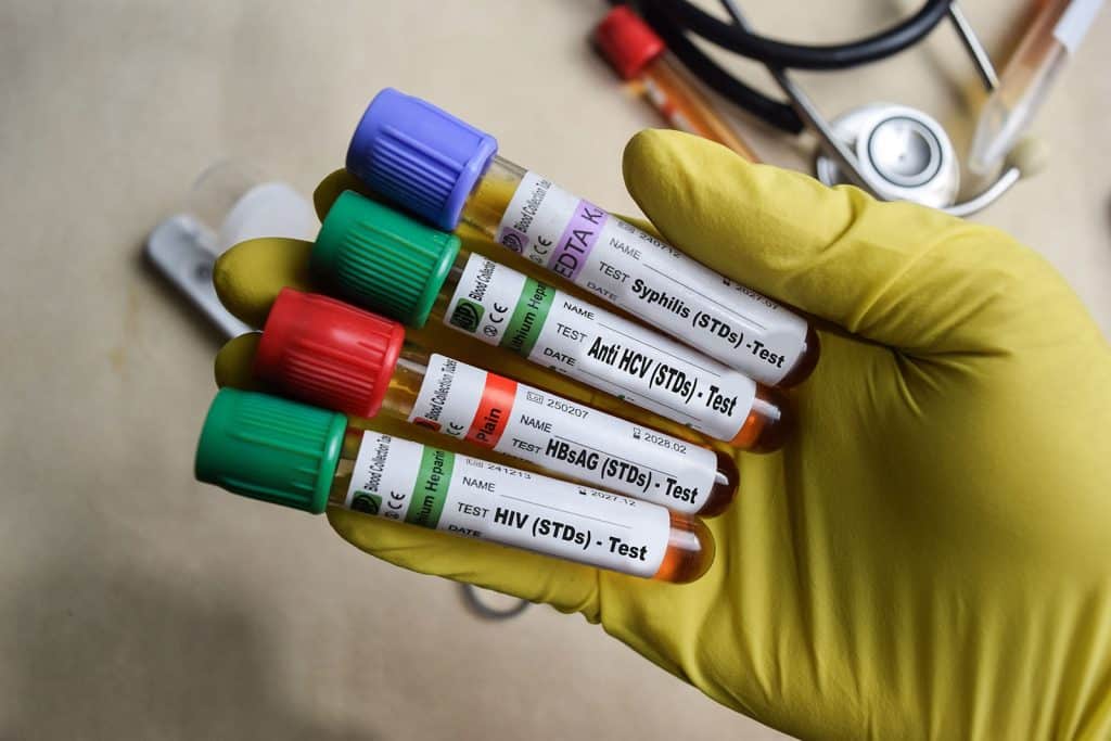 Hepatitis and STDs
